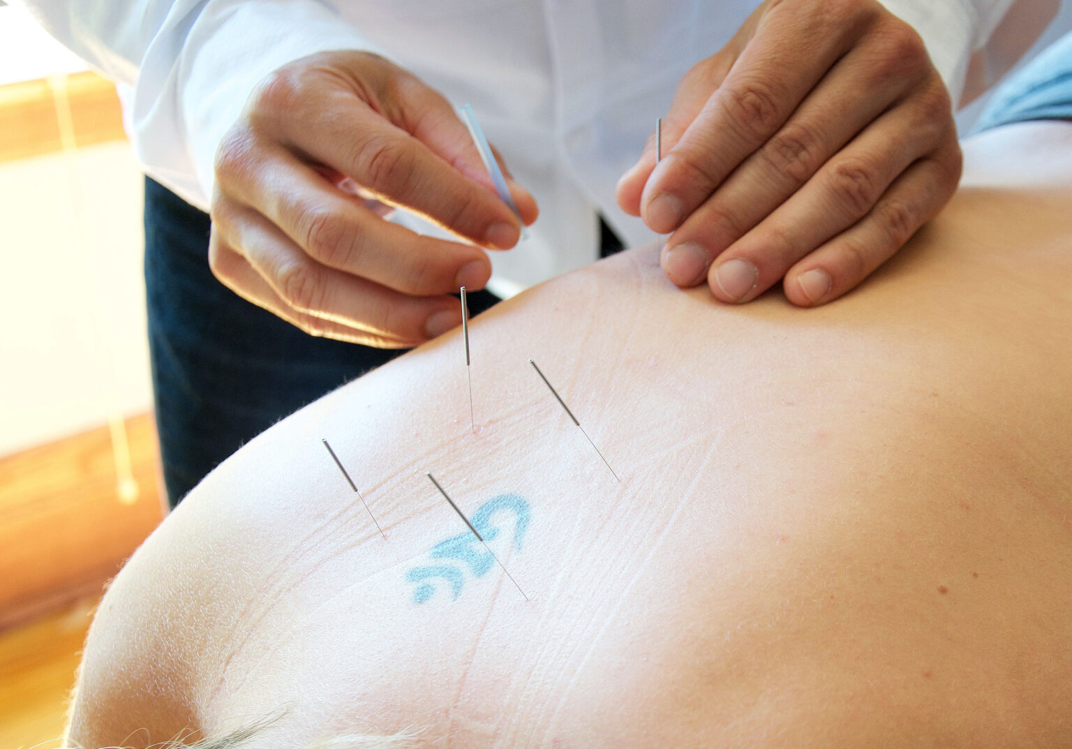 Point Zero Wellness - Professional Acupuncture in Northfield